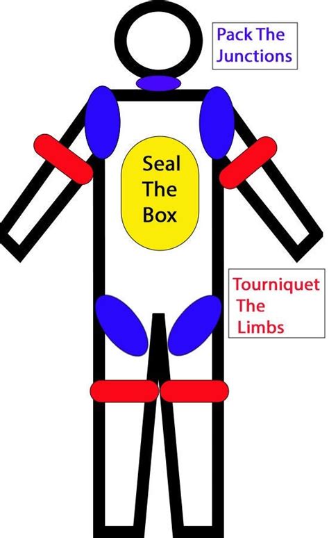 You know I love my infographics. . Wound packing vs tourniquet